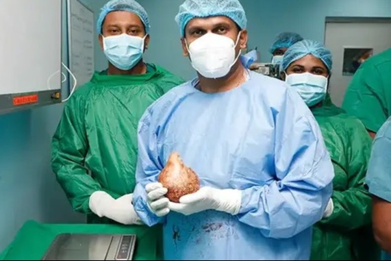 斯里蘭卡男子腎結石大如拳頭 手術成功取出打破世界紀錄
